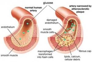 5 Obat Kuat Untuk Penderita Diabetes Yang Aman Halodiabetes Com 5 Obat Kuat Untuk Penderita Diabetes Yang Aman Halodiabetes Com